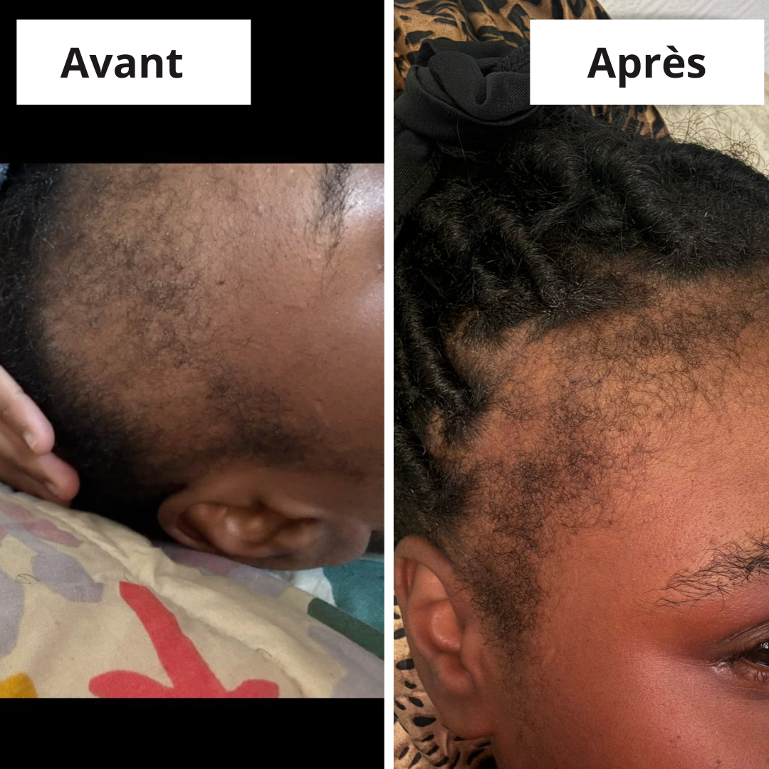 SERUM POUSSE MC OIL artisanal (100ml) - Mc Fell