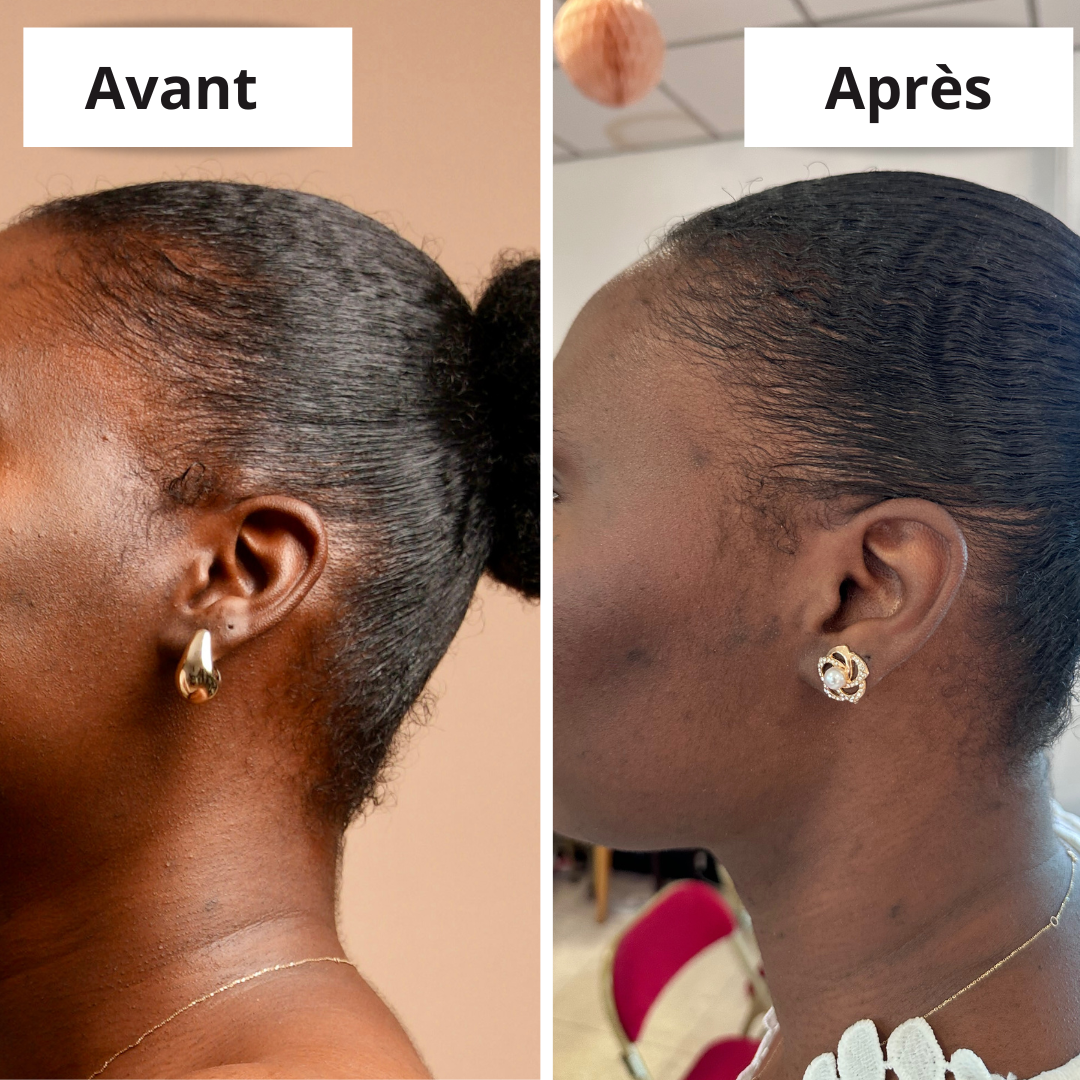 SERUM POUSSE MC OIL artisanal (100ml) - Mc Fell