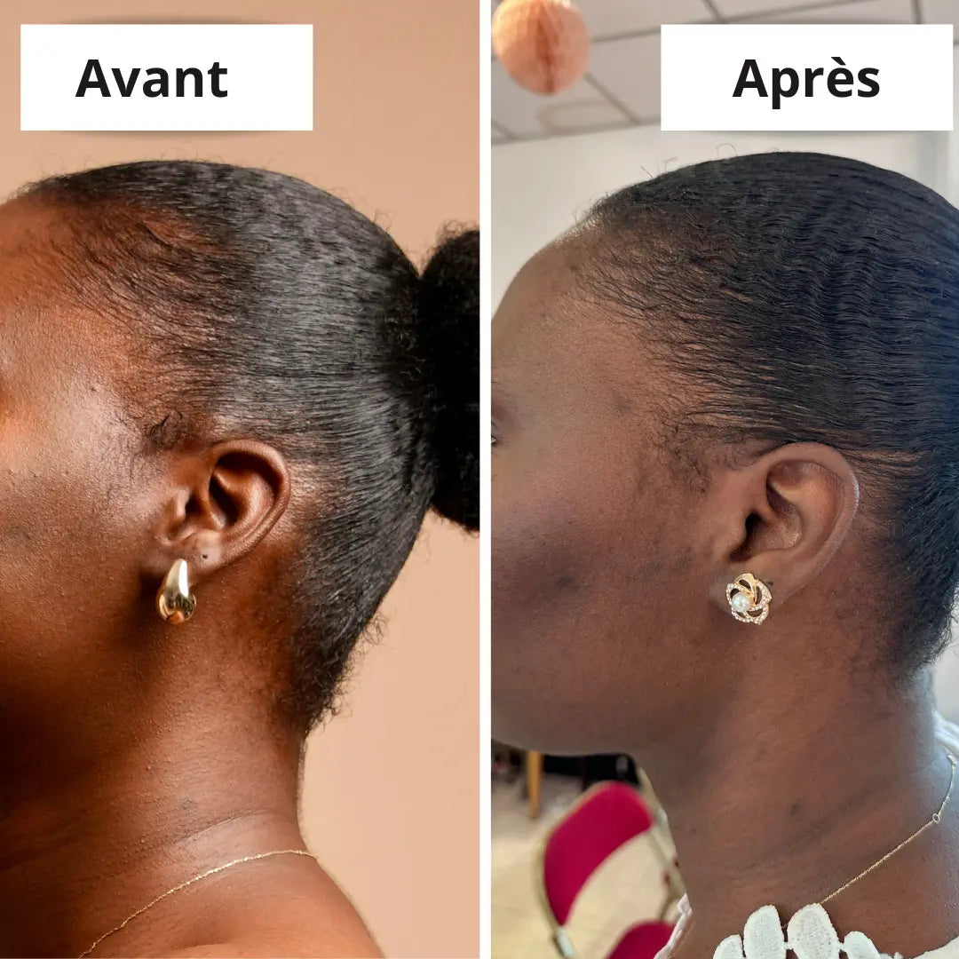 SERUM POUSSE MC OIL artisanal (100ml) - Mc Fell